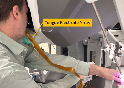 Tongue-based electrotactile stimulation system for surgical feedback